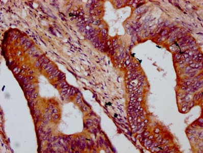 OTOP1 Antibody