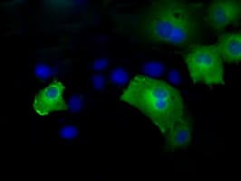 IFT57 / HIPPI Antibody (clone OTI4F6)