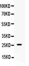 APOA1 / Apolipoprotein A 1 Antibody