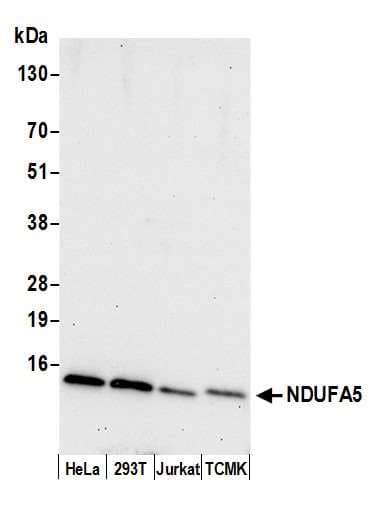 Polyclonal Rabbit anti-Human NDUFA5 Antibody (aa66-116, WB)