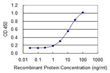 Monoclonal Mouse anti-Human CRABP2 Antibody (clone 4F2, WB)