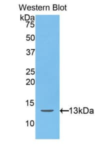 HAMP / Hepcidin Antibody (aa25-84)