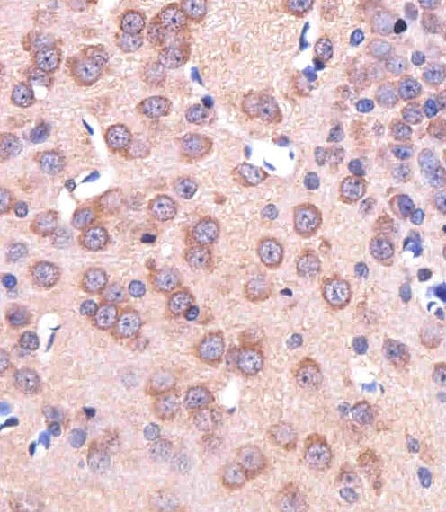 Polyclonal Rabbit anti-Human SLC29A1 / ENT1 Antibody (aa402-431, IHC, WB)