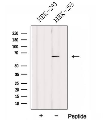 Polyclonal Rabbit anti-Human FBXW5 Antibody (WB)