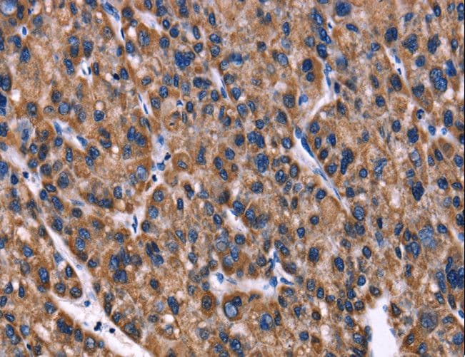 PHB / Prohibitin Antibody