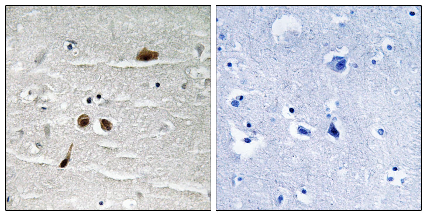MDC1 Antibody (phospho-Ser513)
