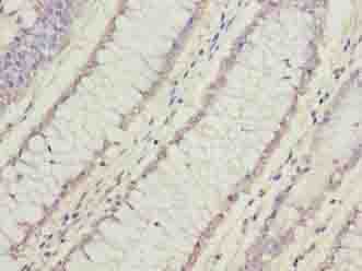 Polyclonal Rabbit anti-Human FAM78A Antibody (IHC, WB)
