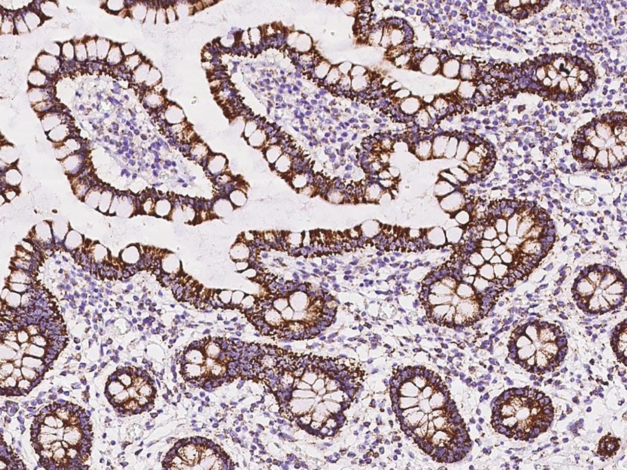Polyclonal Rabbit anti-Human Rhodanese / TST Antibody (IHC, IF, WB)