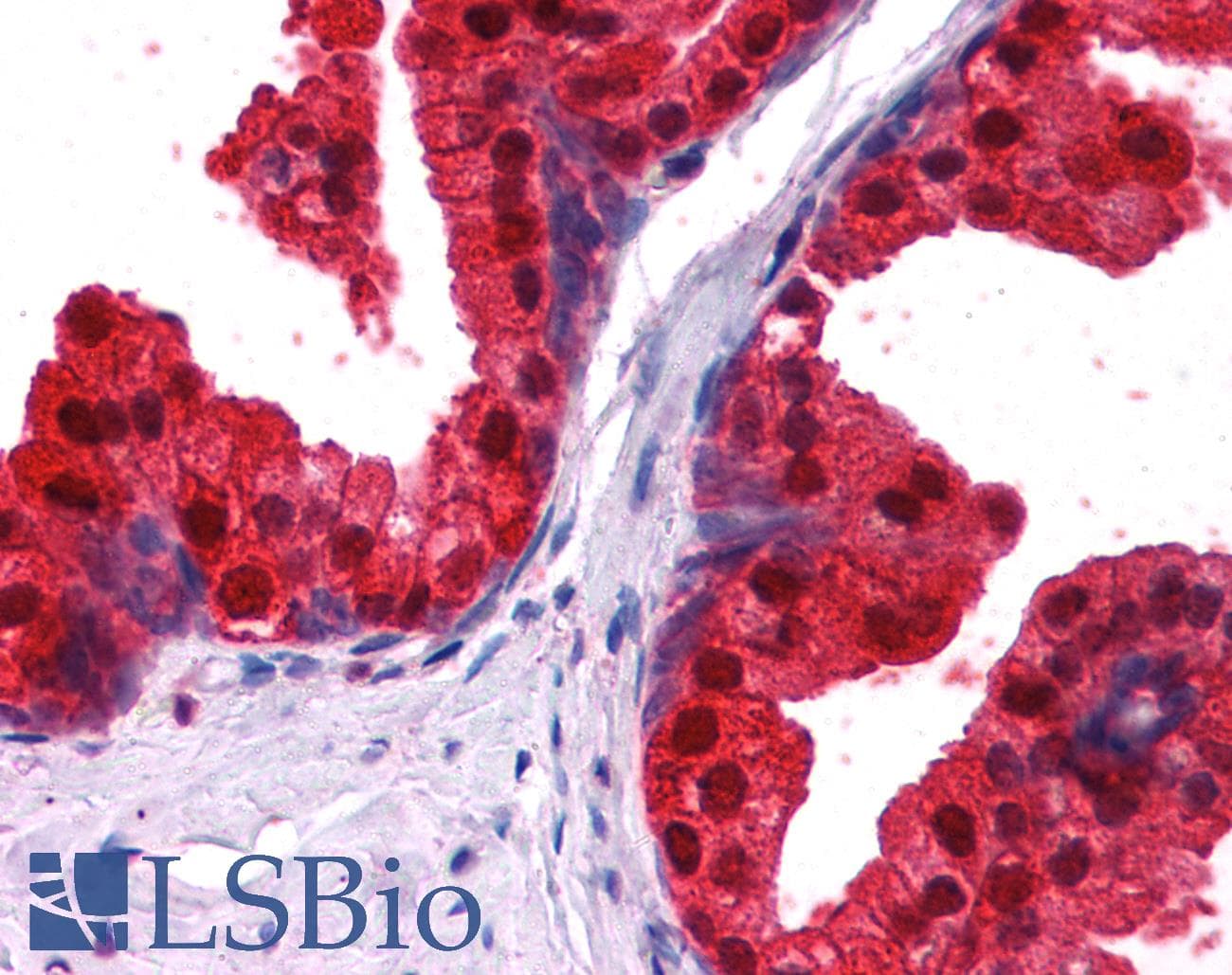 PathPlus™ NDRG1 Antibody (aa382-394)