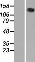 VARS / ValRS Protein (Over-Expression Lysate Myc-DDK (Flag))