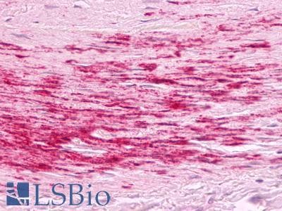 PathPlus™ Polyclonal Rabbit anti-Human B1R / BDKRB1 Antibody (Cytoplasmic Domain, IHC)