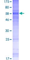 Human GPRC5A / RAI3 Protein (Recombinant GST)