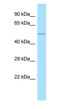 ALG10 / KCR1 Antibody (aa193-242)