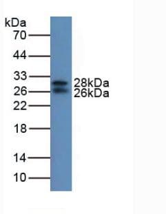 IGFBP7 / TAF Antibody (aa88-281)