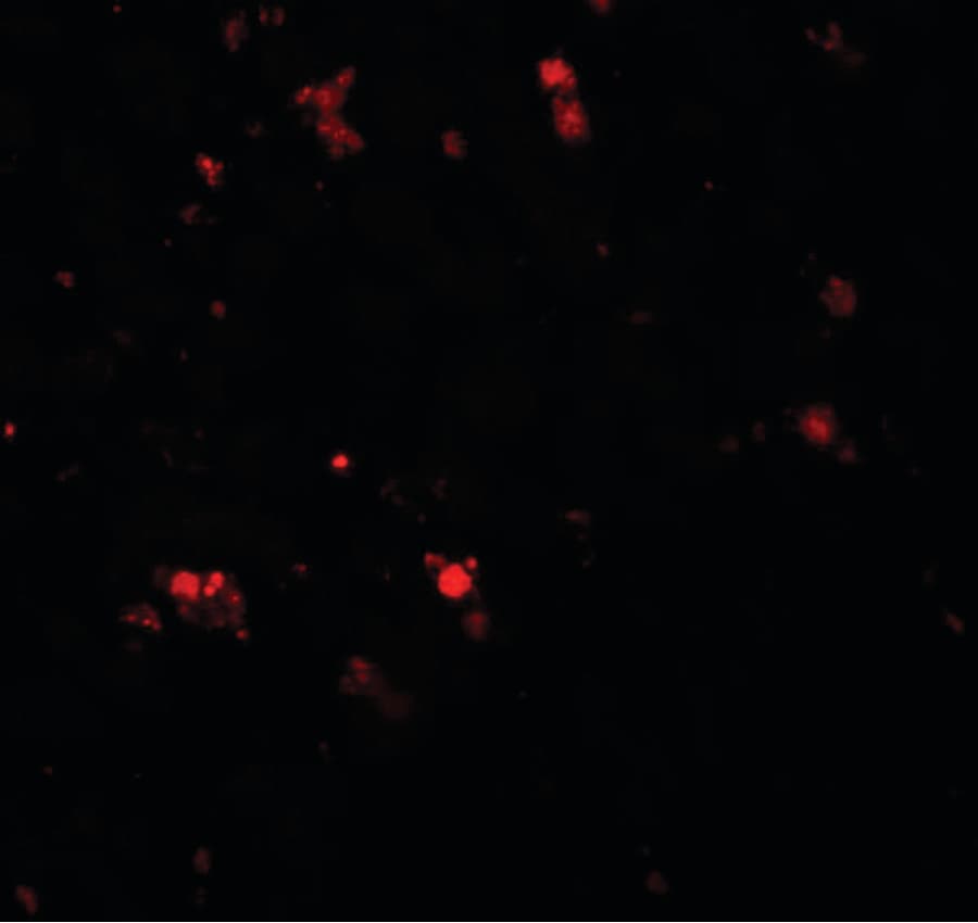 IHC-plus™ ELOVL7 Antibody