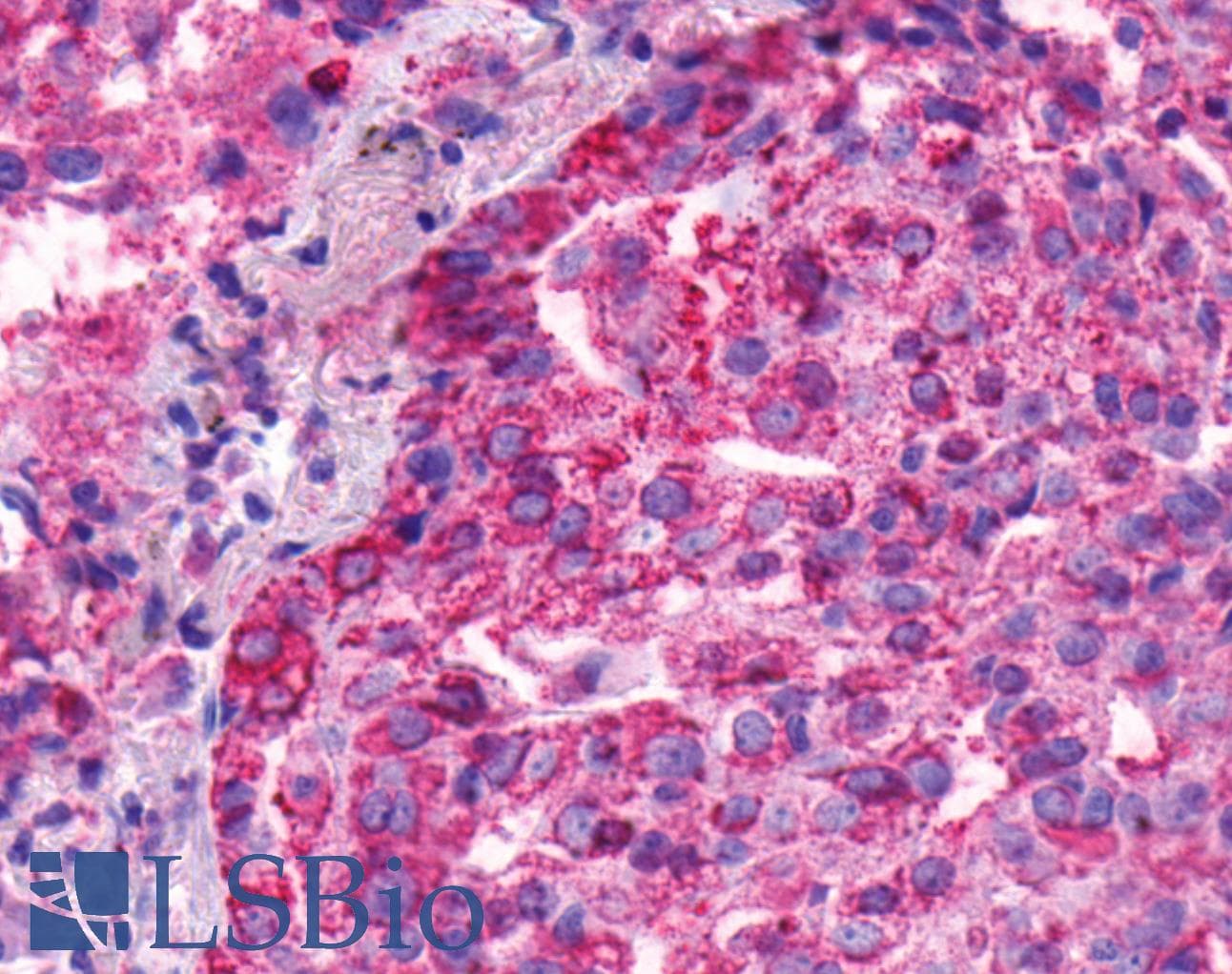 IHC-plus™ Polyclonal Rabbit anti-Human ADGRB1 / BAI1 Antibody (C-Terminus, IHC)