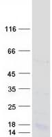 Human RSRC2 Protein (Recombinant Myc-DDK (Flag))