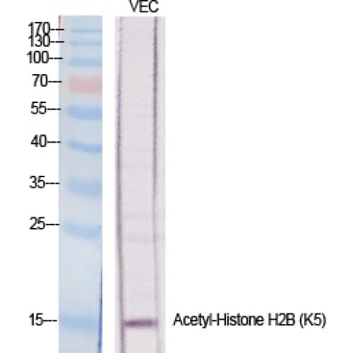 Histone H2B Antibody (1-80 aa)