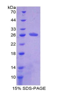 Mouse HAUS7 Protein (Recombinant His)