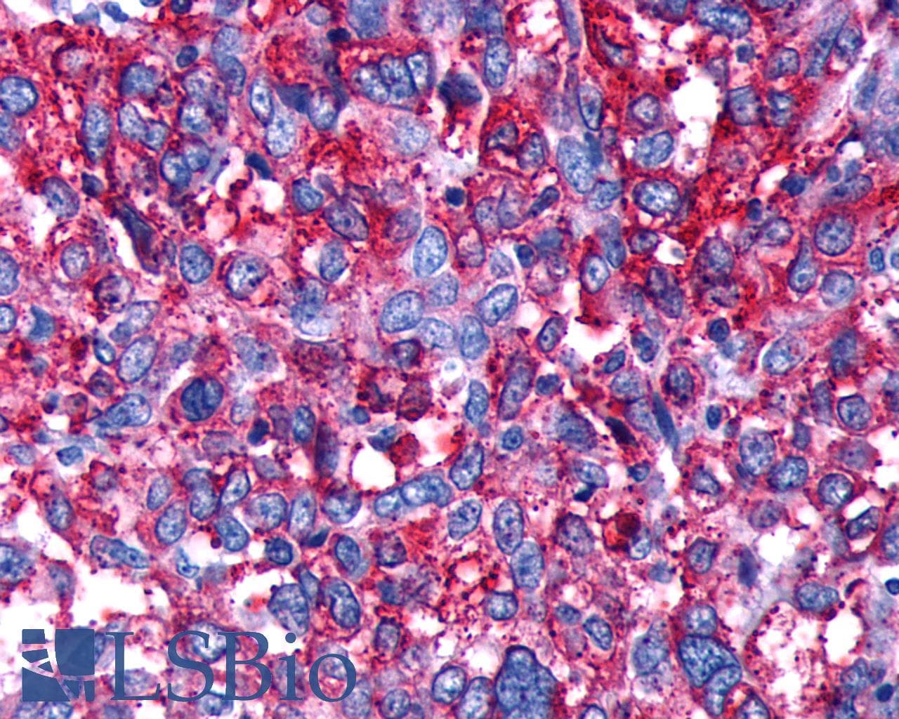 PathPlus™ Polyclonal Rabbit anti-Human DRD4 / Dopamine Receptor D4 Antibody (C-Terminus, IHC)