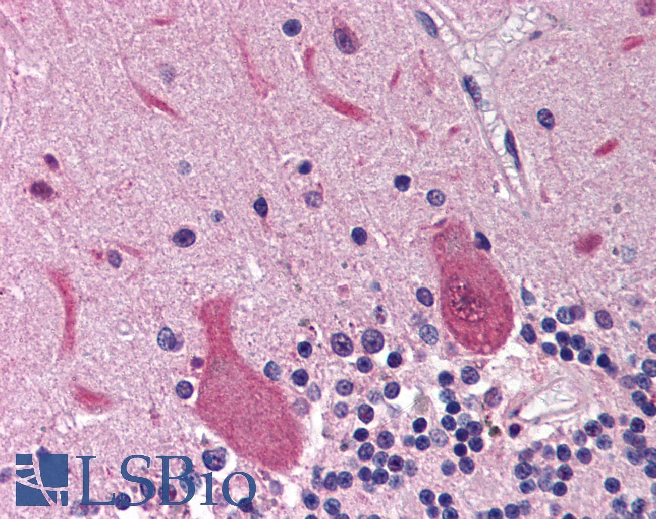 IHC-plus™ RRM2B / P53R2 Antibody