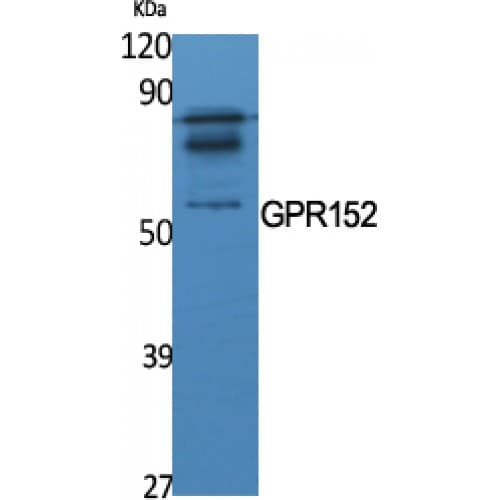 Polyclonal Rabbit anti-Human GPR152 Antibody (10-90 aa, N-terminal, IF, WB)