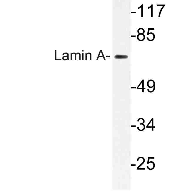 Polyclonal Rabbit anti-Human LMNA / Lamin A+C Antibody (Ser17, IHC, WB)