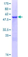 Human NPL / C112 Protein (Recombinant GST)