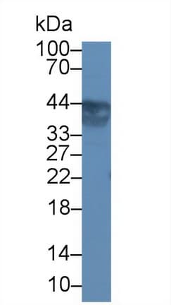 UPK3A / UPK3 / Uroplakin III Antibody (aa15-211, HRP)