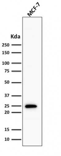 PathPlus™ BCL2 / Bcl-2 Antibody (clone BCL2/1878R)