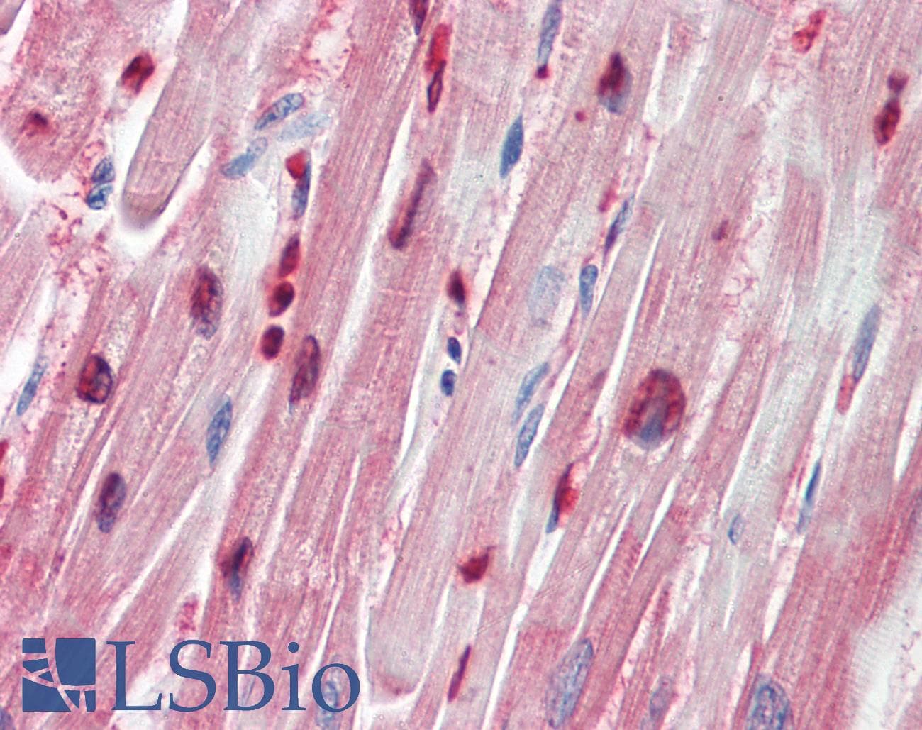 IHC-plus™ ZEB1 / AREB6 Antibody