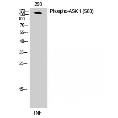 MAP3K5 / ASK1 Antibody (20-100 aa)