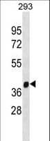 PHF9 / FANCL Antibody (aa274-302)