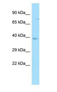 Polyclonal Rabbit anti-Human GPR35 Antibody (C-Terminus, WB)