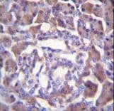 Polyclonal Rabbit anti-Human PRSS3 / Trypsin 3 Antibody (aa136-163, IHC, WB)