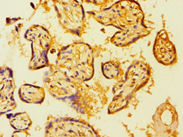 ETK / BMX Antibody (aa65-280)