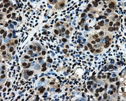 LOX / Lysyl Oxidase Antibody (clone OTI9G6)