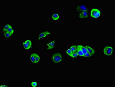 GJB2 / CX26 / Connexin 26 Antibody