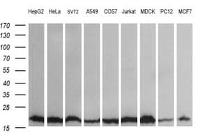 IHC-plus™ UBE2G2 Antibody (clone 4D6)