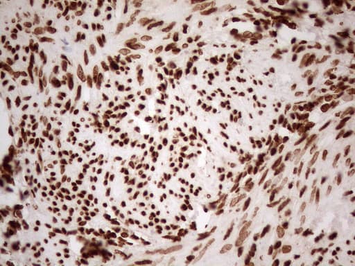 Monoclonal Mouse anti-Human ALOX5 / 5-LOX Antibody (clone OTI3F1, aa18-364, IHC, WB)