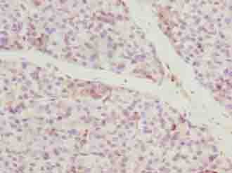 Polyclonal Rabbit anti-Human CCDC89 Antibody (IHC, WB)