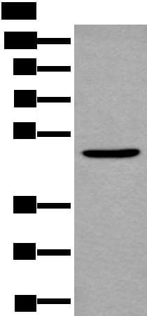 B4GAT1 / B3GNT1 Antibody