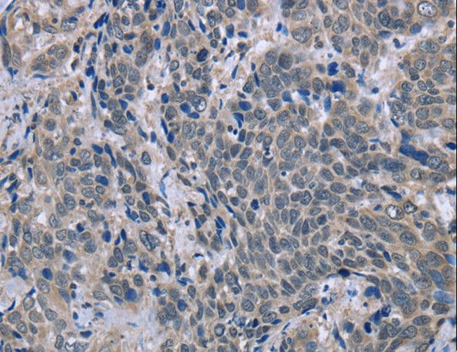 ETK / BMX Antibody