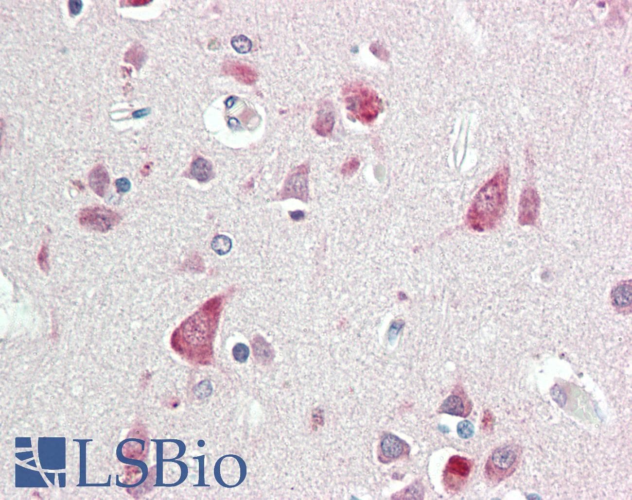 IHC-plus™ FAC1 / BPTF Antibody (clone 2F10)