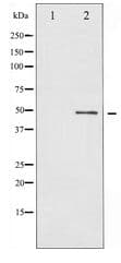 BLNK Antibody
