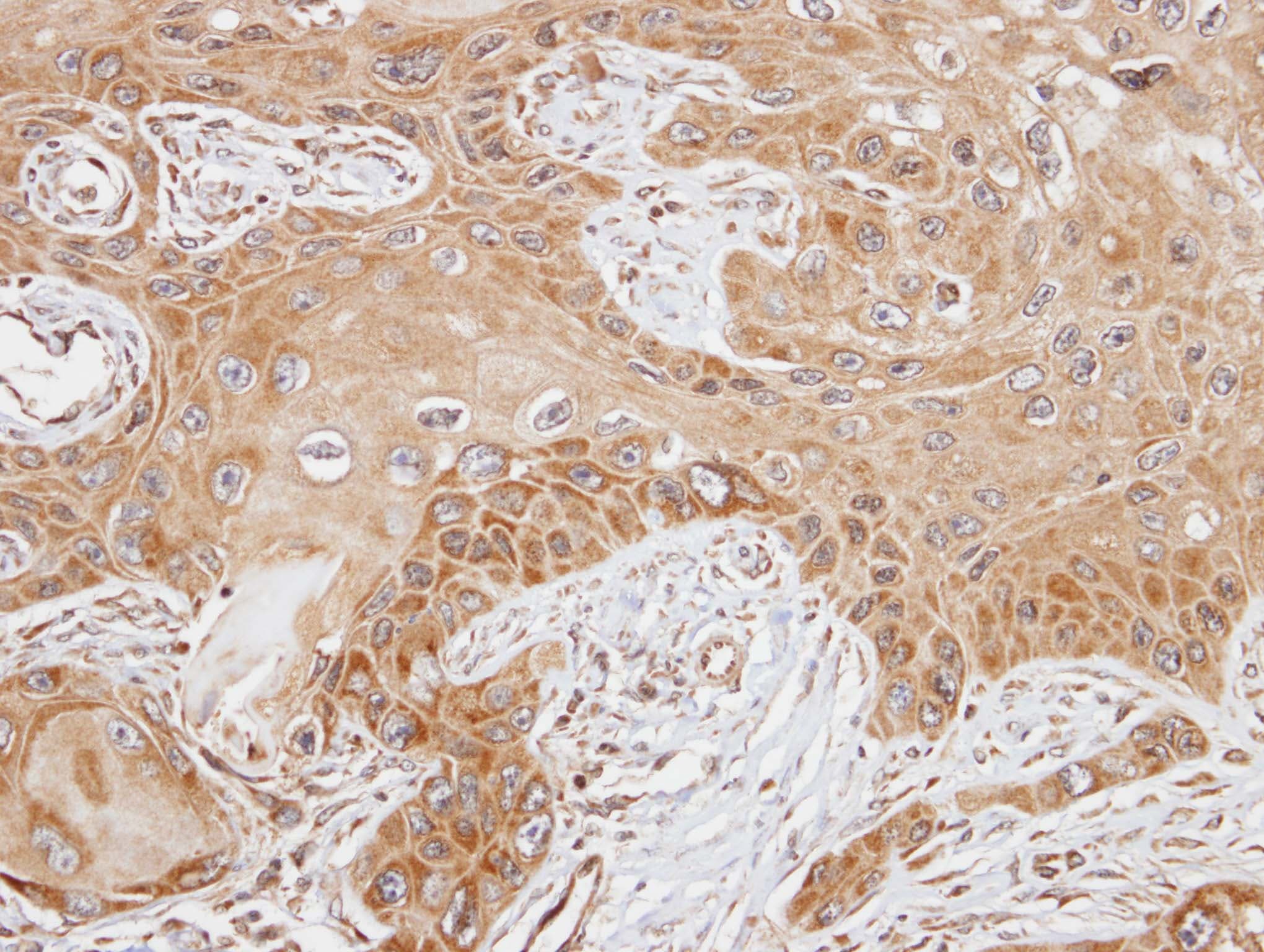 Polyclonal Rabbit anti-Human FASTK / FAST Antibody (aa346-549, IHC, WB)