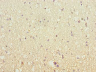 SH3GL2 Antibody