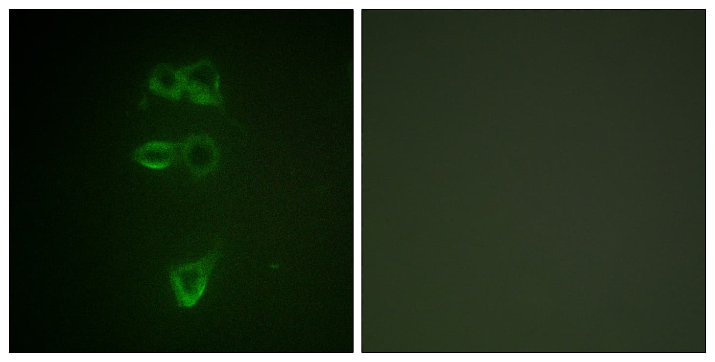 TEK / TIE2 Antibody (phospho-Tyr1108)