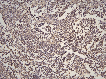 HOOK3 Antibody