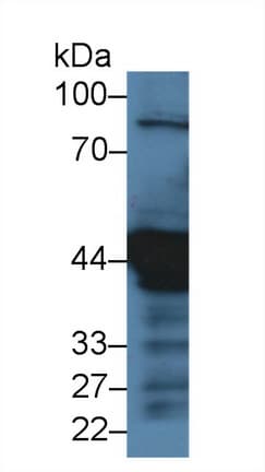 KRT18 / CK18 / Cytokeratin 18 Antibody (aa1-159)